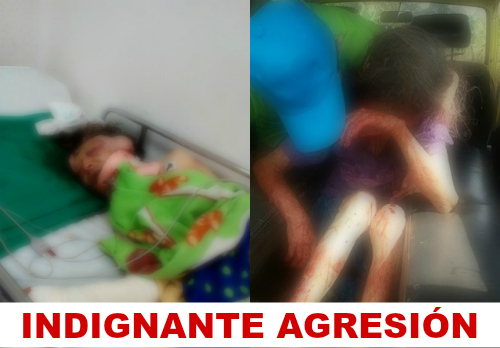 Indignante agresión a una abuela en el municipio de La Cumbre